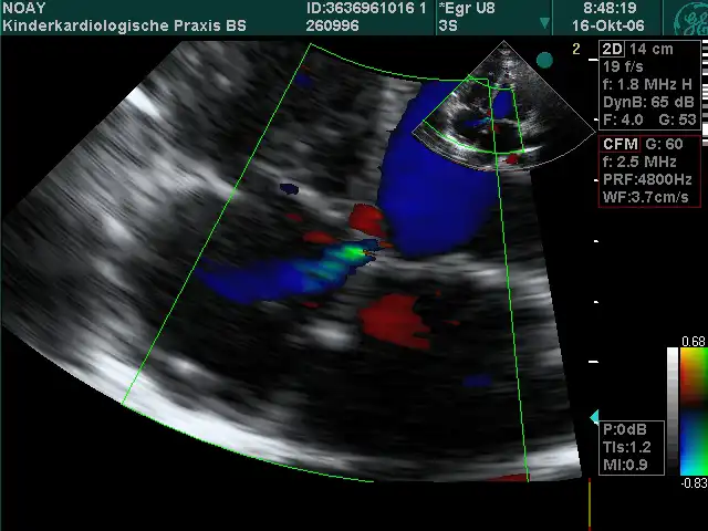 Ultraschall-Untersuchung des Herzens - Kinderkardiologische Gemeinschaftspraxis
